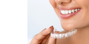 Orthodontie à Lille : gouttières / aligneurs invisibles