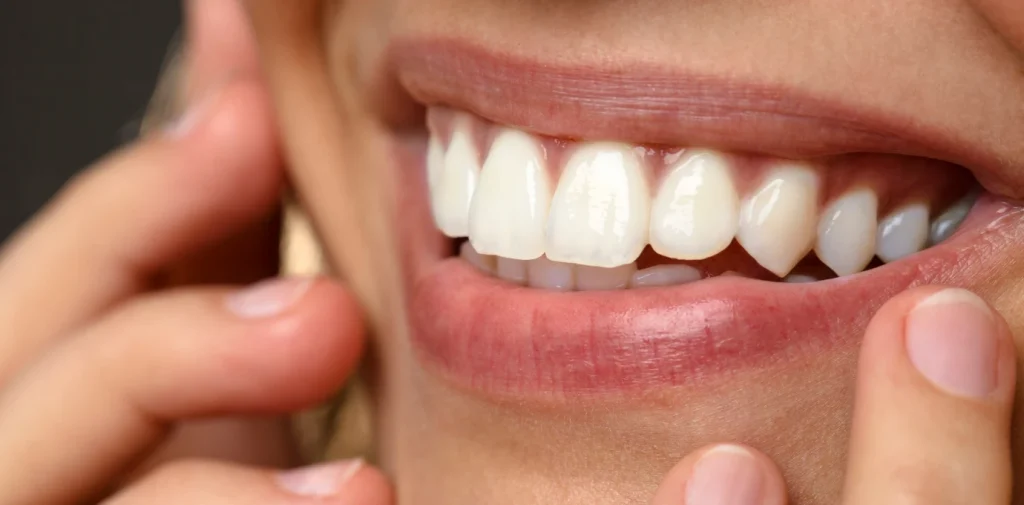 Tâches et dents jaunes, Traitement des pathologies dentaires à Lille